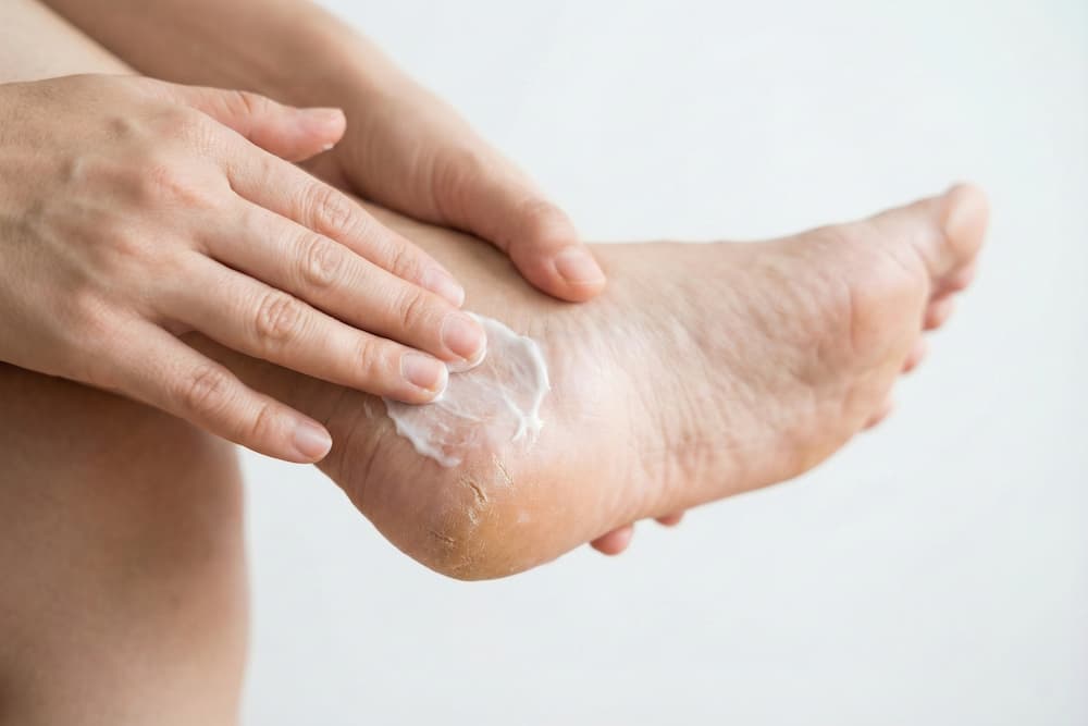 Et nærbillede af hænder, der masserer en hvid, fugtgivende creme ind i den tørre hud på hælen. Billedet illustrerer vigtigheden af daglig fugtpleje for at forebygge hælrevner og bevare huden blød og smidig.