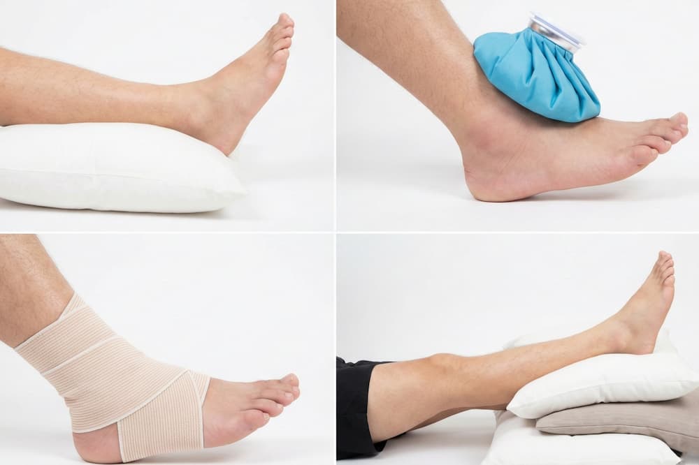 Et collage af fire billeder, der demonstrerer R.I.C.E.-metoden til behandling af akutte fodskader. Øverst til venstre ses "Rest" med foden hvilende på en pude, til højre "Ice" med en ispose på anklen. Nederst til venstre vises "Compression" med et elastikbind, og til højre "Elevation", hvor benet er løftet højt over hjertehøjde.